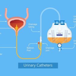 Foley catheter care nurse teaching