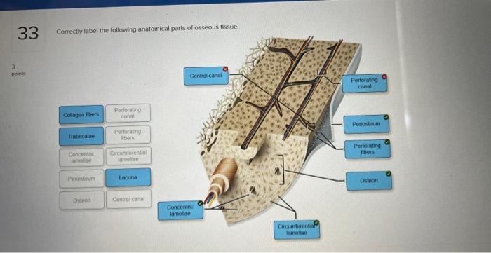 Correctly label the following anatomical parts of osseous tissue.